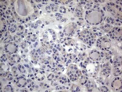 Immunohistochemistry: VSIG3/IGSF11 Antibody (OTI2H1) [NBP2-46046]