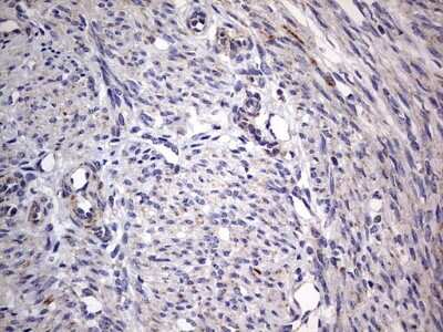 Immunohistochemistry: VSIG3/IGSF11 Antibody (OTI2H1) [NBP2-46046]