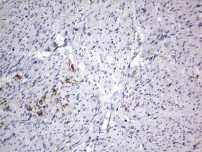 Immunohistochemistry: VSIG3/IGSF11 Antibody (OTI2H1) [NBP2-46046]