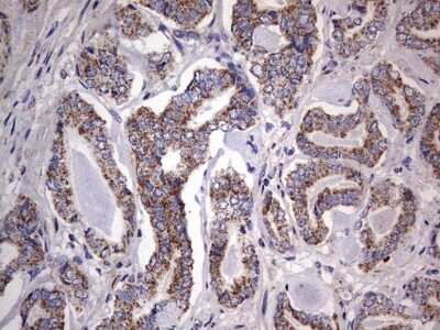 Immunohistochemistry: VSIG3/IGSF11 Antibody (OTI2H1) [NBP2-46046]