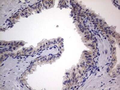 Immunohistochemistry: VSIG3/IGSF11 Antibody (OTI2H1) [NBP2-46046]