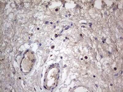 Immunohistochemistry: VSIG3/IGSF11 Antibody (OTI2H1) [NBP2-46046]