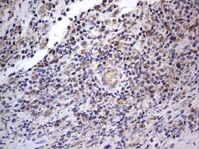Immunohistochemistry: VSIG3/IGSF11 Antibody (OTI2H1) [NBP2-46046]