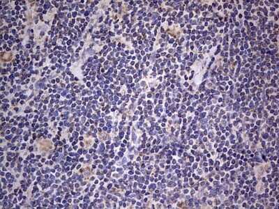 Immunohistochemistry: VSIG3/IGSF11 Antibody (OTI2H1) [NBP2-46046]