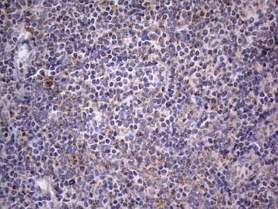 Immunohistochemistry: VSIG3/IGSF11 Antibody (OTI2H1) [NBP2-46046]