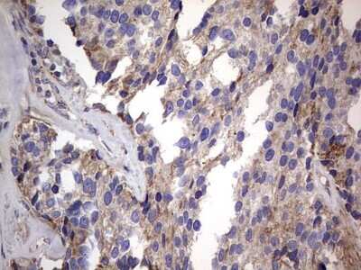 Immunohistochemistry: VSIG3/IGSF11 Antibody (OTI2H1) [NBP2-46046]