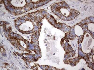 Immunohistochemistry: VSIG3/IGSF11 Antibody (OTI2H1) [NBP2-46046]