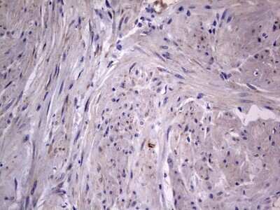 Immunohistochemistry: VSIG3/IGSF11 Antibody (OTI2H1) [NBP2-46046]