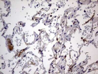 Immunohistochemistry: VSIG3/IGSF11 Antibody (OTI2H1) [NBP2-46046]