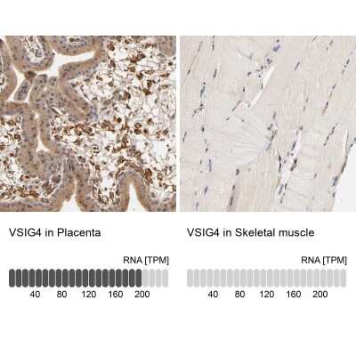 Immunohistochemistry-Paraffin: VSIG4 Antibody [NBP1-86843]