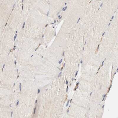 Immunohistochemistry-Paraffin: VSIG4 Antibody [NBP1-86843]