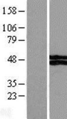 Western Blot: VSIG4 Overexpression Lysate [NBL1-17763]