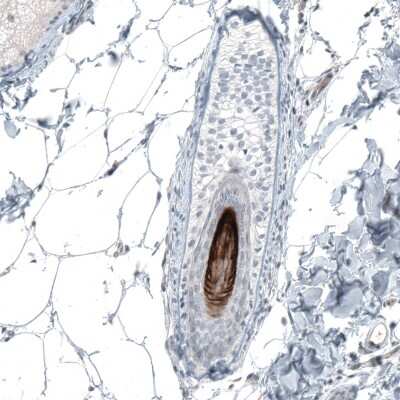 Immunohistochemistry-Paraffin: VSIG8 Antibody [NBP1-86415]