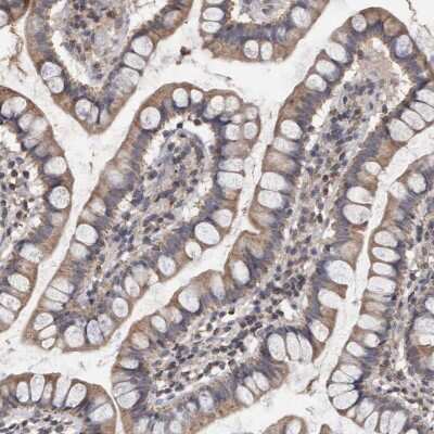 Immunohistochemistry-Paraffin: VSIG8 Antibody [NBP1-86415]