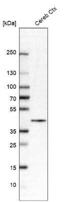 Western Blot: VSTM2A Antibody [NBP1-81113]