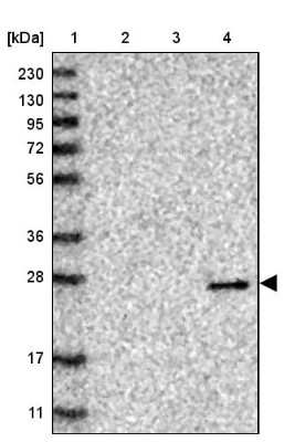 Western Blot: VSTM2A Antibody [NBP1-81114]