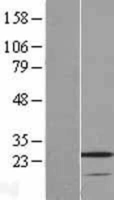 Western Blot: VSTM2A Overexpression Lysate [NBL1-17765]