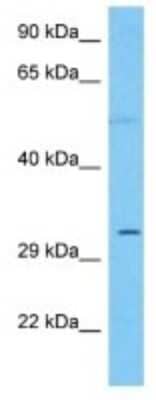 Western Blot: VSTM2B Antibody [NBP3-10212]