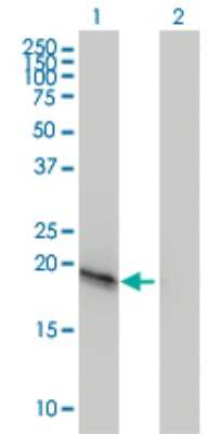 Western Blot: VSTM2L Antibody (3B9) [H00128434-M01]