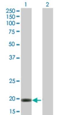 Western Blot: VSTM2L Antibody [H00128434-B01P]