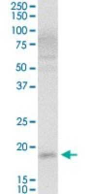 Western Blot: VSTM2L Antibody [H00128434-D01P]