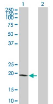 Western Blot: VSTM2L Antibody [H00128434-D01P]