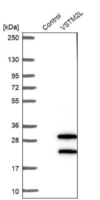 Western Blot: VSTM2L Antibody [NBP1-92577]