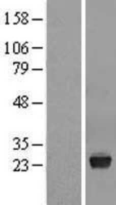 Western Blot: VSTM2L Overexpression Lysate [NBL1-17766]