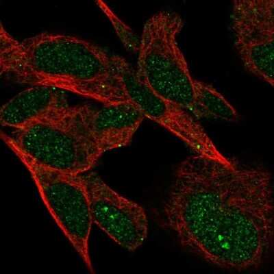 Immunocytochemistry/ Immunofluorescence: VSTM4 Antibody [NBP1-94127]