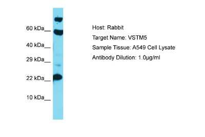 Western Blot: VSTM5 Antibody [NBP2-83758]