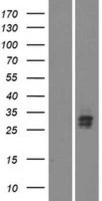 Western Blot: VSTM5 Overexpression Lysate [NBP2-09711]