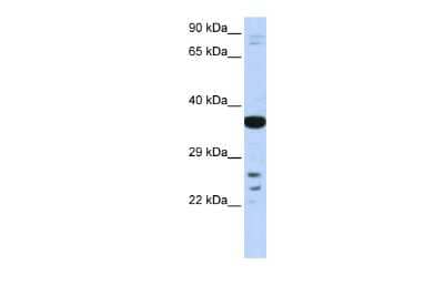 Western Blot: VSX1 Antibody [NBP3-10377]