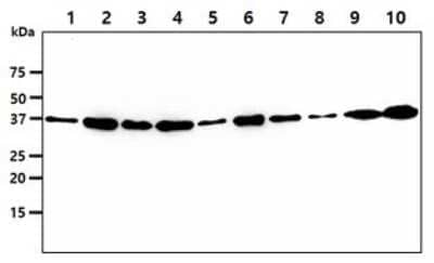 Western Blot: VTA1 Antibody (14G10)BSA Free [NBP2-59420]