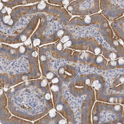 Immunohistochemistry-Paraffin: VTA1 Antibody [NBP1-86745]