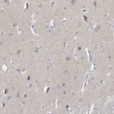 Immunohistochemistry-Paraffin: VTA1 Antibody [NBP1-86745]