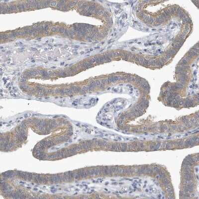 Immunohistochemistry-Paraffin: VTA1 Antibody [NBP1-86745]