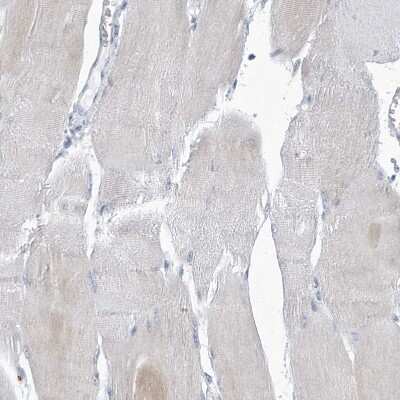 Immunohistochemistry-Paraffin: VTA1 Antibody [NBP1-86745]