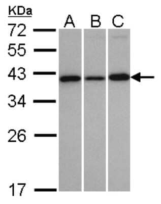 Western Blot: VTA1 Antibody [NBP1-32570]