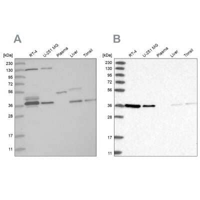 Western Blot: VTA1 Antibody [NBP1-86745]