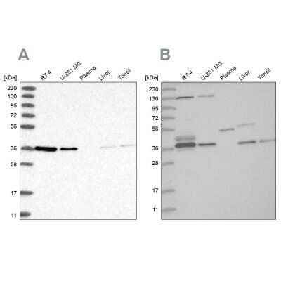 Western Blot: VTA1 Antibody [NBP2-58305]