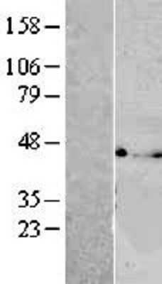 Western Blot: VTA1 Overexpression Lysate [NBL1-17767]