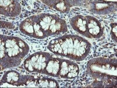 Immunohistochemistry: VTI1A Antibody (OTI1F4) [NBP2-45413]