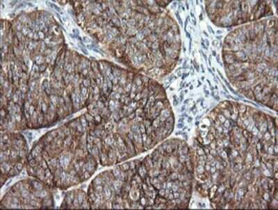 Immunohistochemistry: VTI1A Antibody (OTI1F4) [NBP2-45413]
