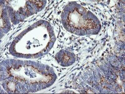 Immunohistochemistry: VTI1A Antibody (OTI1F4) [NBP2-45413]