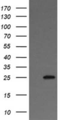 Western Blot: VTI1A Antibody (OTI1F4) [NBP2-45413]