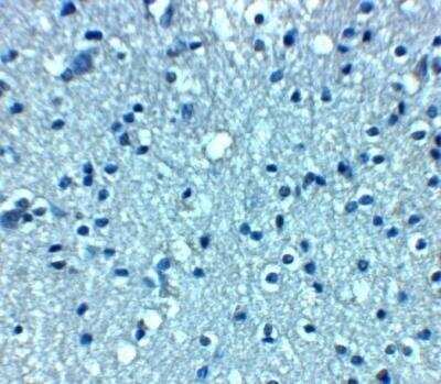Immunohistochemistry: VTI1A Antibody - BSA Free [NBP2-81876]