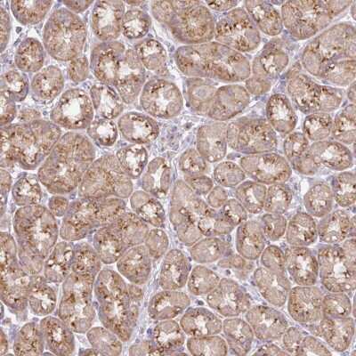 Immunohistochemistry-Paraffin: VTI1A Antibody [NBP2-30952]