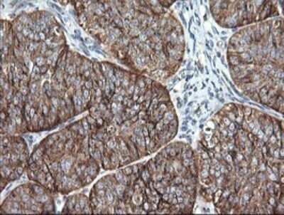 Immunohistochemistry: VTI1A Antibody (OTI1F4) - Azide and BSA Free [NBP2-74862]
