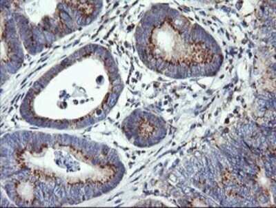 Immunohistochemistry: VTI1A Antibody (OTI1F4) - Azide and BSA Free [NBP2-74862]
