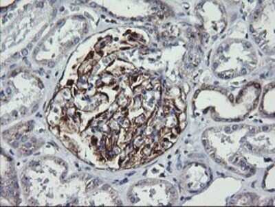 Immunohistochemistry: VTI1A Antibody (OTI1F4) - Azide and BSA Free [NBP2-74862]